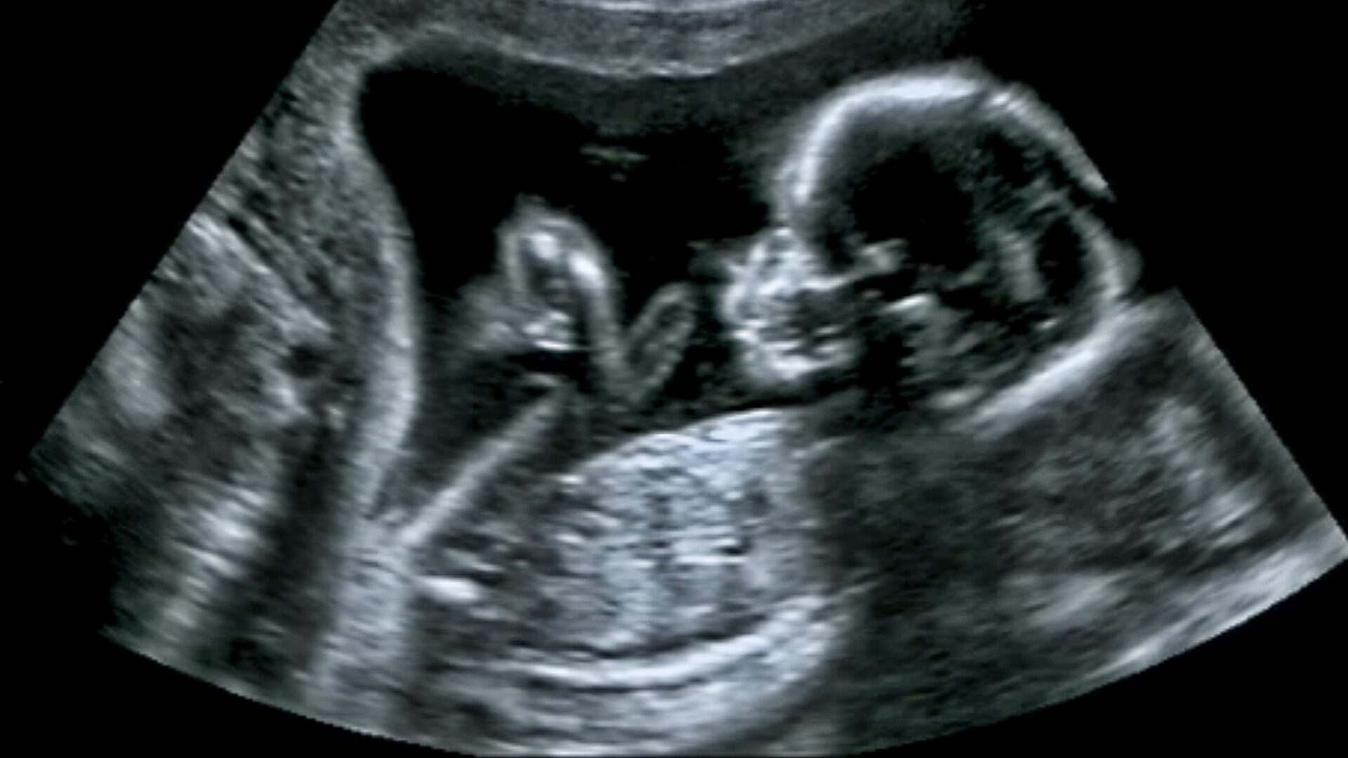 Gavin Newsom ‘Invests’ Millions to Keep Killing the Unborn at Planned Parenthood [WATCH]