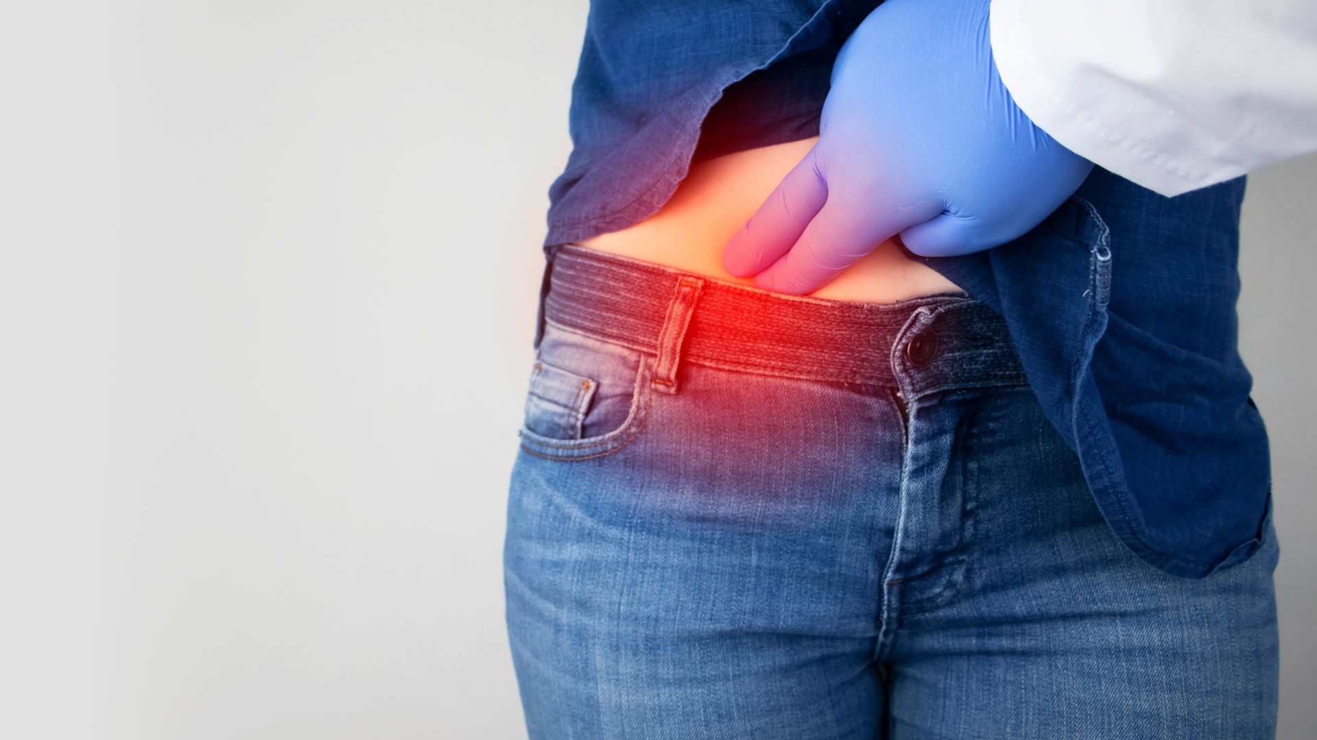 Appendix Cancer Rates Surge Among Millennials, Rising Faster Than Colon Cancer